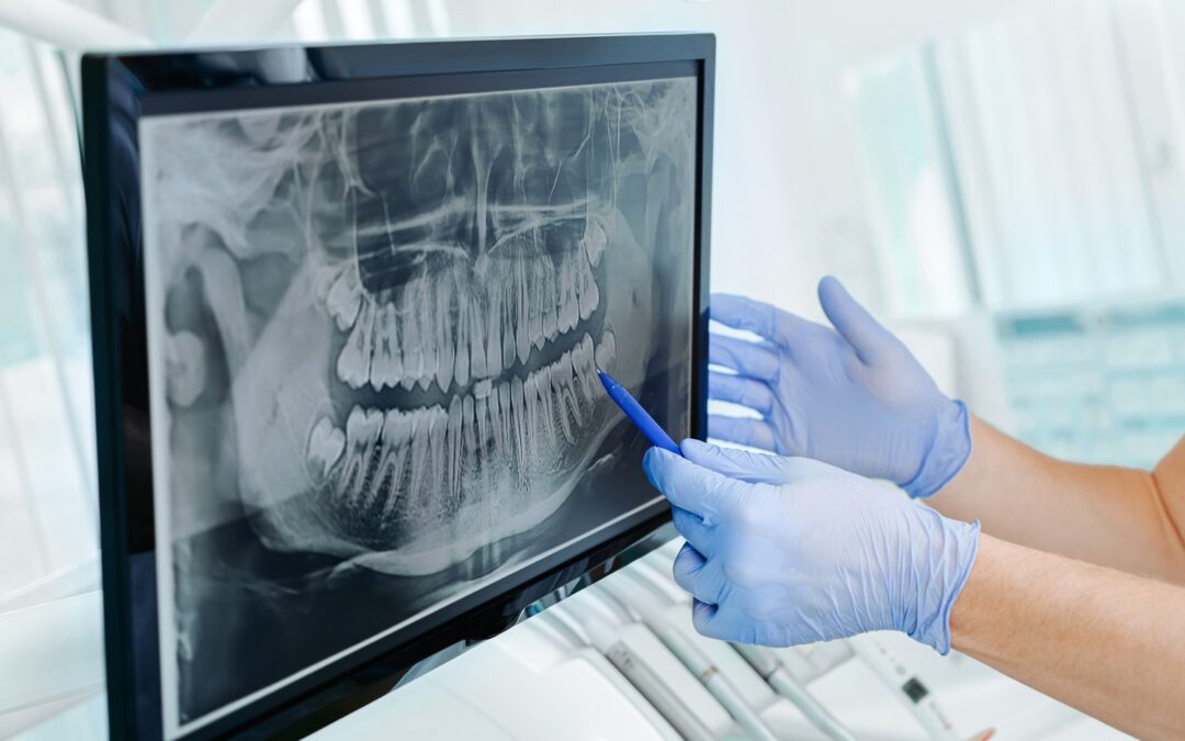 Dentist shows patient their dental x-ray in Maine
